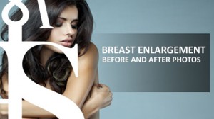 breast enlargement before and after